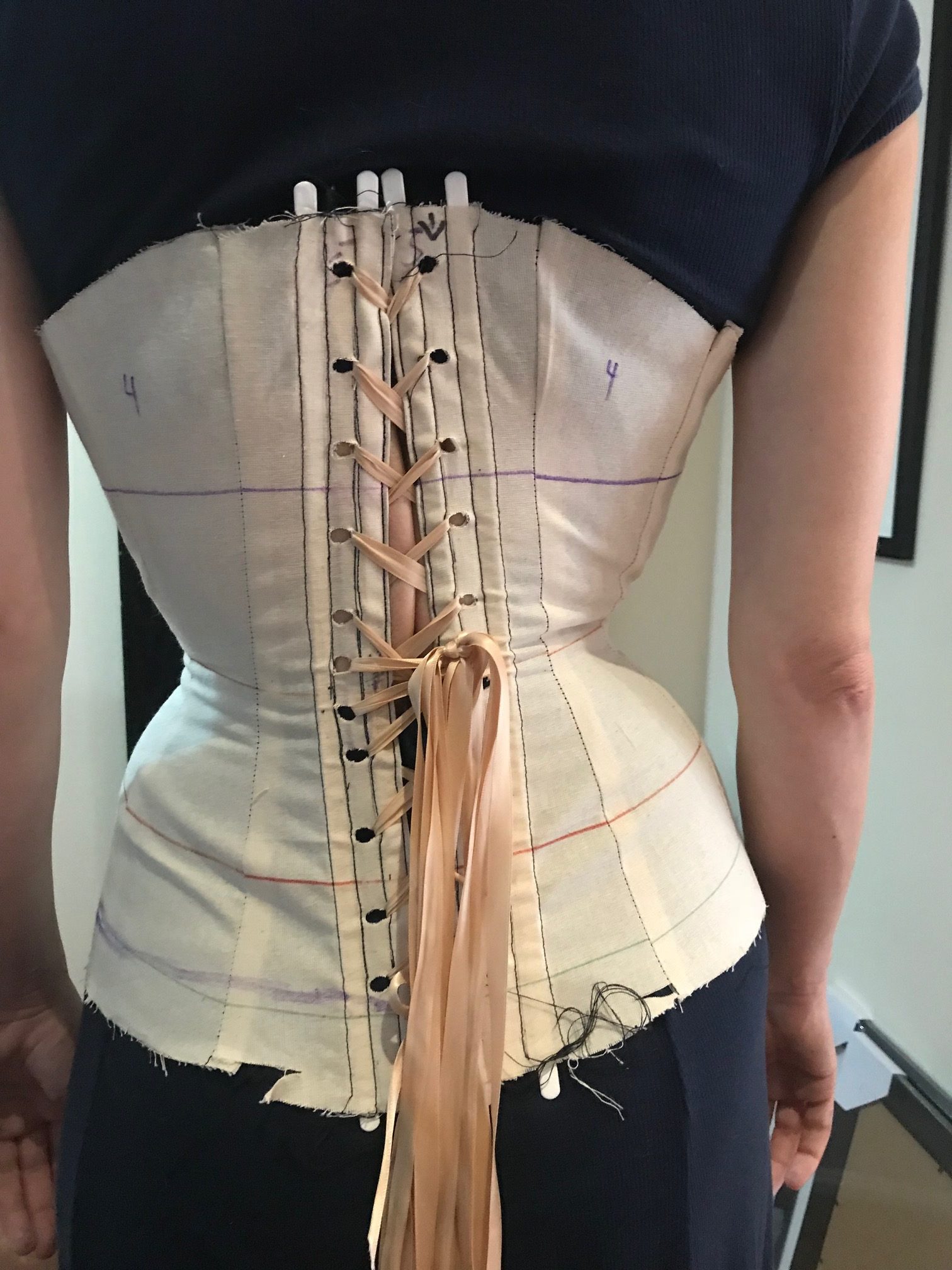 Corsets, scoliosis and back pain
